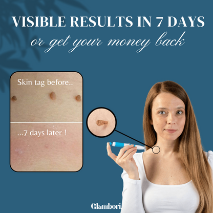 Glambori™ TagAway 2.0